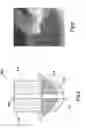 Fig. 07 - Medical devices having a dynamic surface profile and methods for production and use thereof