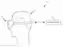 Fig. 01 - Diagnostic eye goggle system