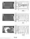 Fig. 17 - SYSTEM AND METHOD FOR A BIOSENSOR INTEGRATED IN A VEHICLE