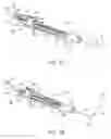 Fig. 02 - Sinus dilation catheter with ultrasonic imaging feature