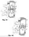 Fig. 05 - Surgical retractor system and method