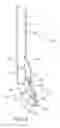 Fig. 09 - Suturing device having adjustable distal end