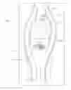 Fig. 01 - Instruments and methods for complete plantar plate repairs