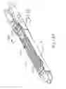 Fig. 99 - Method of applying a buttress to a surgical stapler end effector