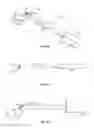 Fig. 02 - Suture passer systems and methods for tongue or other tissue suspension and compression
