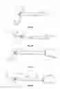 Fig. 04 - Suture passer systems and methods for tongue or other tissue suspension and compression
