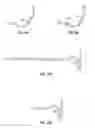 Fig. 09 - Suture passer systems and methods for tongue or other tissue suspension and compression