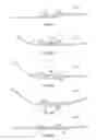 Fig. 10 - Suture passer systems and methods for tongue or other tissue suspension and compression