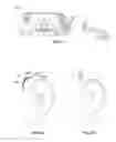 Fig. 20 - Suture passer systems and methods for tongue or other tissue suspension and compression