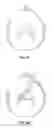 Fig. 23 - Suture passer systems and methods for tongue or other tissue suspension and compression