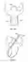 Fig. 28 - Suture passer systems and methods for tongue or other tissue suspension and compression