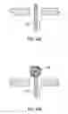 Fig. 33 - Suture passer systems and methods for tongue or other tissue suspension and compression