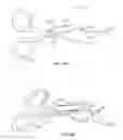 Fig. 34 - Suture passer systems and methods for tongue or other tissue suspension and compression