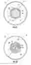 Fig. 14 - Occluding catheter with an optional common inflation and guideware channel and method of use