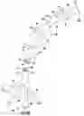Fig. 16 - Occluding catheter with an optional common inflation and guideware channel and method of use