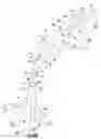 Fig. 17 - Occluding catheter with an optional common inflation and guideware channel and method of use