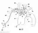 Fig. 19 - Occluding catheter with an optional common inflation and guideware channel and method of use