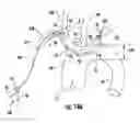 Fig. 22 - Occluding catheter with an optional common inflation and guideware channel and method of use