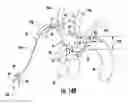 Fig. 23 - Occluding catheter with an optional common inflation and guideware channel and method of use