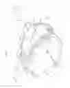 Fig. 02 - Radial and ulnar compression band