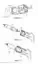 Fig. 06 - Surgical guide for positioning a resurfacing head implant