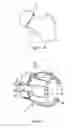 Fig. 08 - Surgical guide for positioning a resurfacing head implant