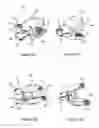 Fig. 10 - Surgical guide for positioning a resurfacing head implant