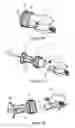 Fig. 11 - Surgical guide for positioning a resurfacing head implant