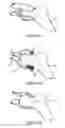 Fig. 12 - Surgical guide for positioning a resurfacing head implant