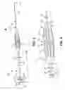Fig. 04 - Lithotripsy Probes and Methods for Performing Lithotripsy