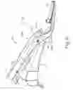Fig. 35 - Alignment features for ultrasonic surgical instrument