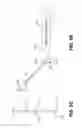 Fig. 11 - Method and apparatus for endoscopic ligament release
