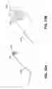 Fig. 12 - Method and apparatus for endoscopic ligament release