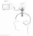 Fig. 06 - Cannula with proximally mounted camera