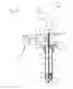 Fig. 07 - Cannula with proximally mounted camera