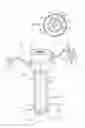 Fig. 02 - Method and system for gas maintenance to a body cavity using a trocar