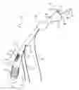Fig. 01 - Apparatus for treating a portion of a reproductive system and related methods of use