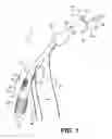 Fig. 02 - Apparatus for treating a portion of a reproductive system and related methods of use