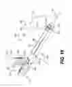 Fig. 20 - Apparatus for treating a portion of a reproductive system and related methods of use