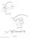 Fig. 22 - Apparatus and methods for accessing and sealing bodily vessels and cavities