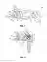 Fig. 07 - Fixation device for proximal humerus fractures
