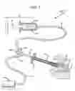 Fig. 02 - Tumor ablation system