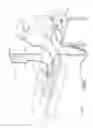 Fig. 02 - Electrosurgical system with suction control apparatus, system and method