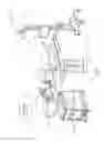 Fig. 02 - Robotic shoulder repair and reconstruction
