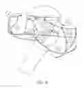 Fig. 05 - Robotic shoulder repair and reconstruction