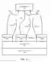 Fig. 08 - Docking device for optical shape sensing launch fixtures