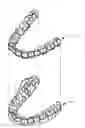 Fig. 01 - Orthodonitic appliance with precision cutout