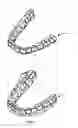 Fig. 02 - Orthodonitic appliance with precision cutout