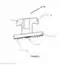 Fig. 02 - SMART ORTHODONTIC BRACKET