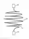 Fig. 01 - Monofilament implants and systems for delivery thereof